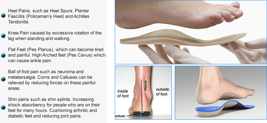 bespoke orthotics in hayes london